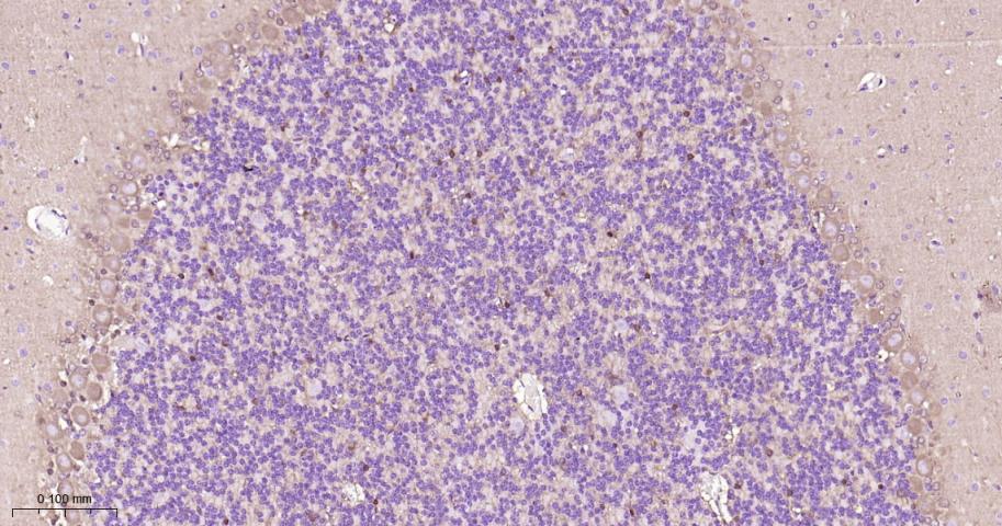 磷酸甘油酸脱氢酶单克隆抗体-bsm-60570M