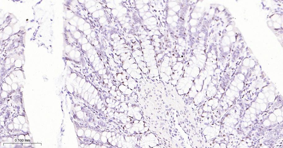 选择性剪接因子3B亚基1重组兔单抗