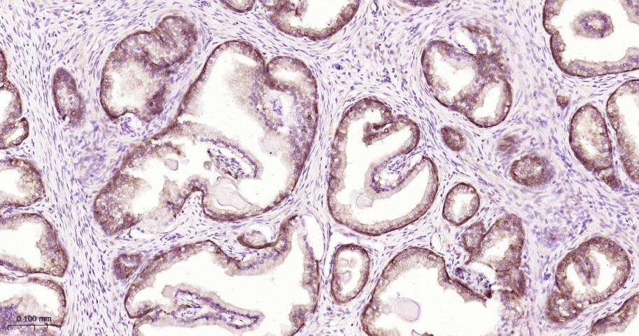 磷酸甘油酸脱氢酶单克隆抗体-bsm-60570M