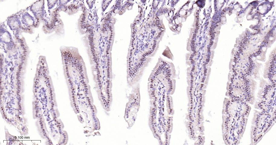 选择性剪接因子3B亚基1重组兔单抗