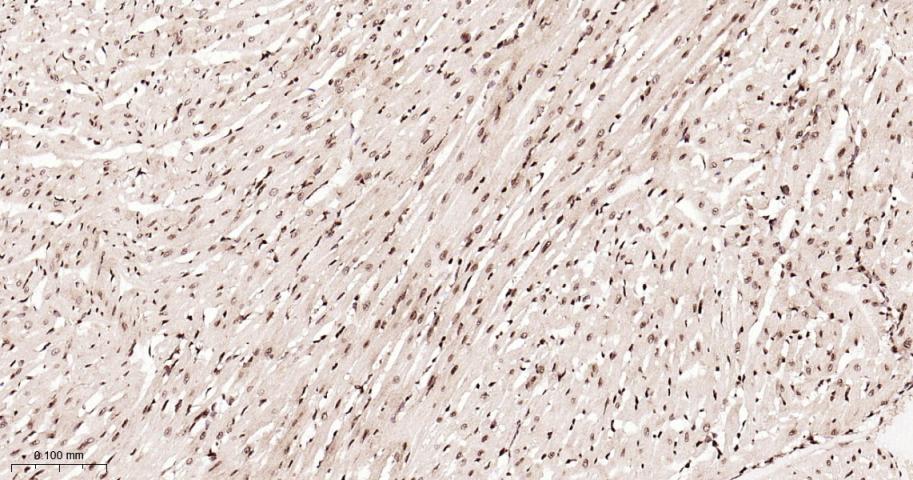 ALYREF重组兔单抗