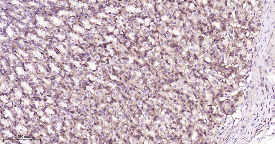 细胞膜钙ATP酶1重组兔单抗