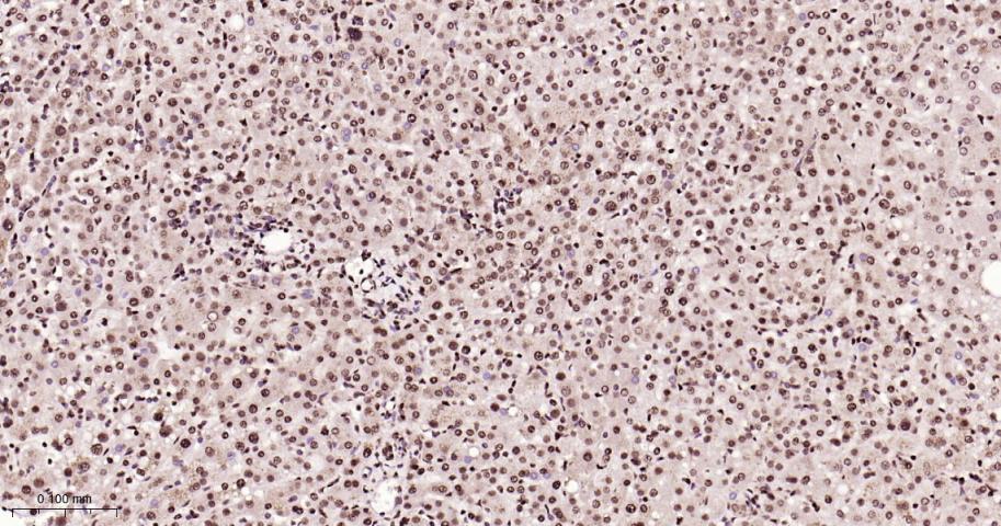 ALYREF重组兔单抗