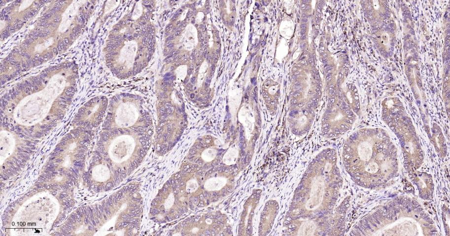 磷酸化干扰素诱导的双链RNA活化蛋白激酶重组兔单抗