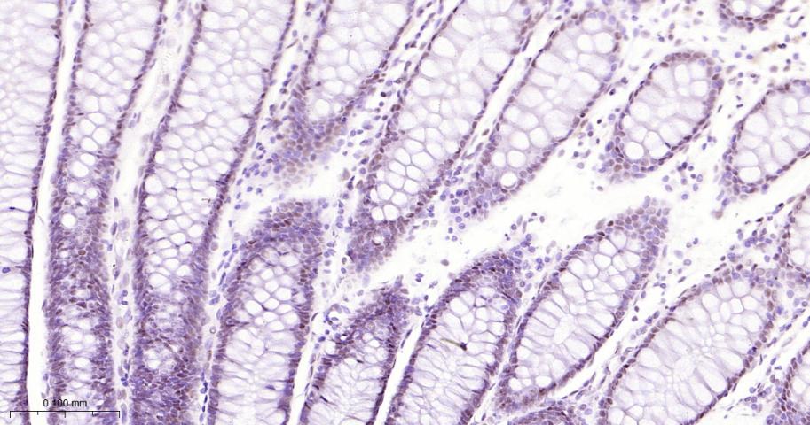 选择性剪接因子3B亚基1重组兔单抗