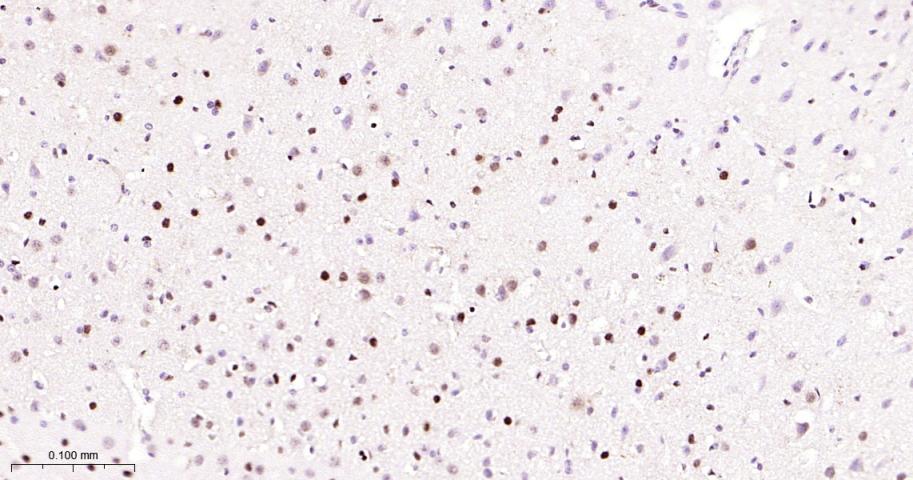 选择性剪接因子3B亚基1重组兔单抗