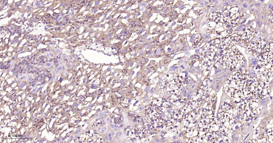 细胞膜钙ATP酶1重组兔单抗