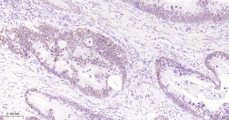 选择性剪接因子3B亚基1重组兔单抗