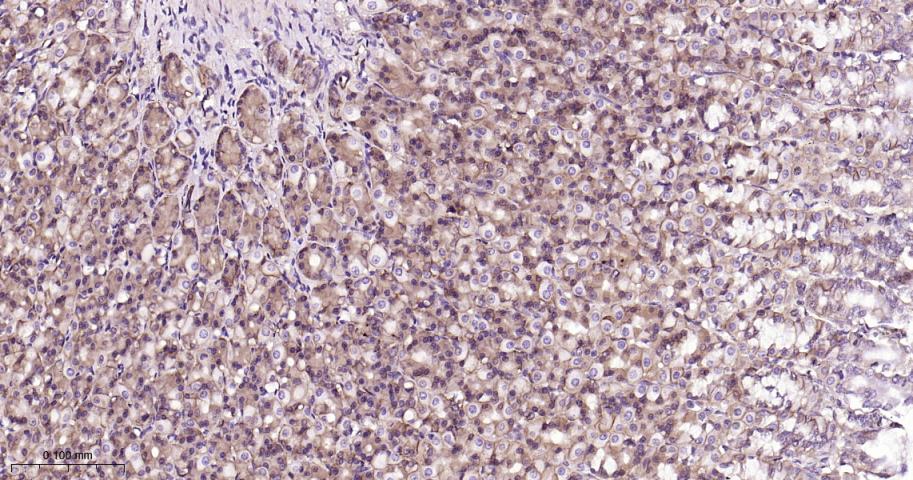 细胞膜钙ATP酶1重组兔单抗