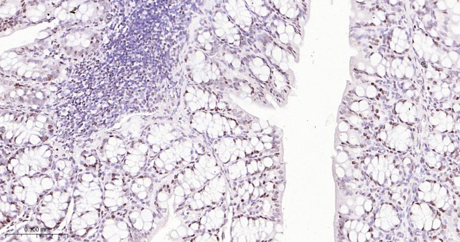 选择性剪接因子3B亚基1重组兔单抗