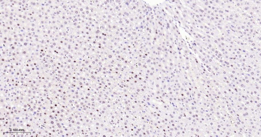 选择性剪接因子3B亚基1重组兔单抗
