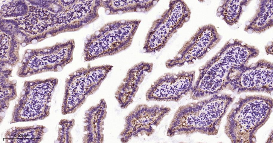 细胞膜钙ATP酶1重组兔单抗