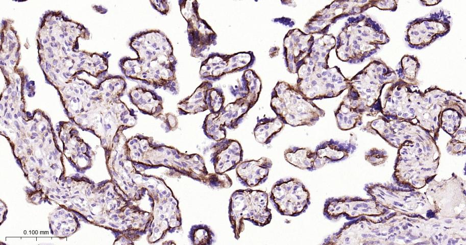 细胞膜钙ATP酶1重组兔单抗