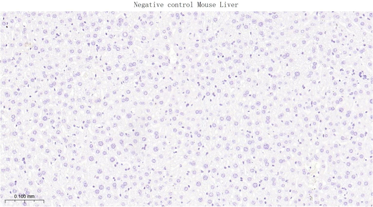 胞质紧密粘连蛋白1/闭锁小带蛋白1重组兔单抗
