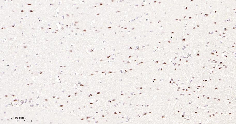 选择性剪接因子3B亚基1重组兔单抗