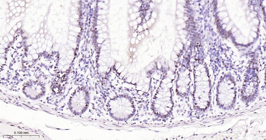 选择性剪接因子3B亚基1重组兔单抗