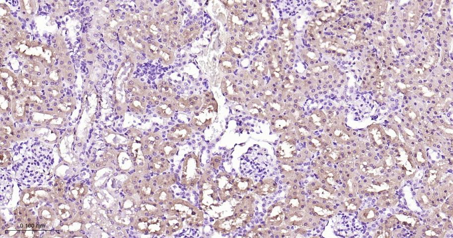 磷酸甘油酸脱氢酶单克隆抗体-bsm-60570M