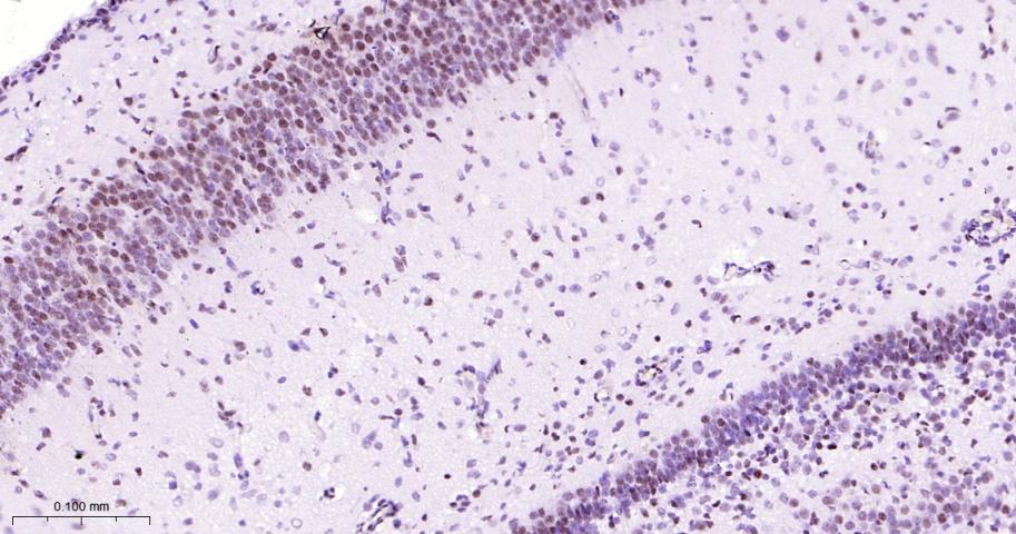选择性剪接因子3B亚基1重组兔单抗