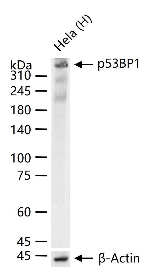 p53结合蛋白1重组兔单抗