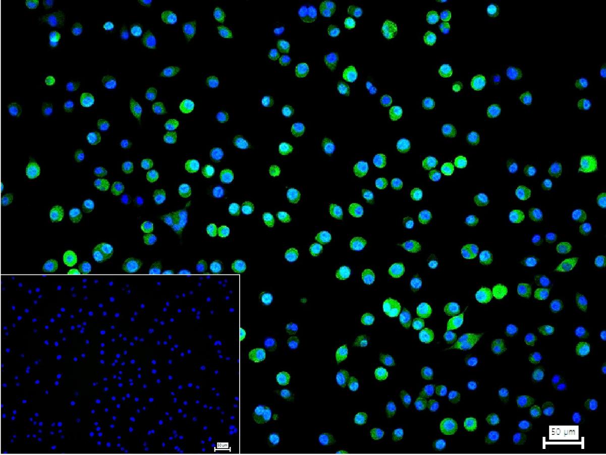 3-磷酸甘油醛脱氢酶(内参)重组兔单抗