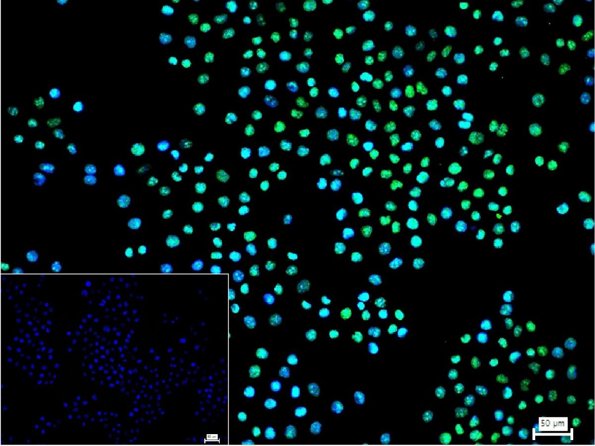 磷酸化核因子2相关因子2(Ser40)重组兔单抗