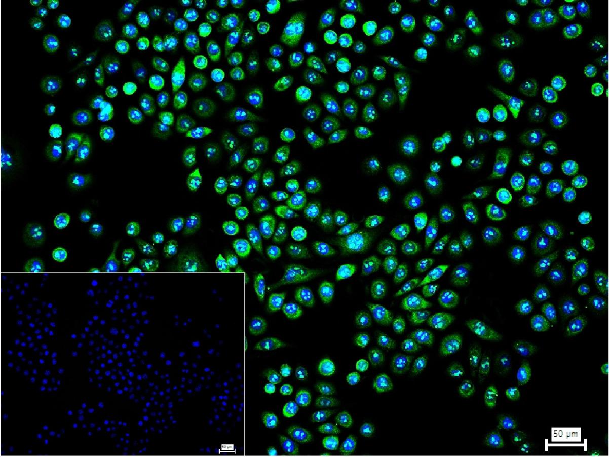 核因子2相关因子2重组兔单抗
