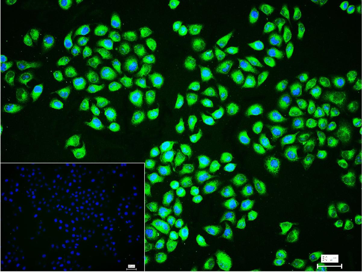 ATP合成酶β5重组兔单克隆抗体