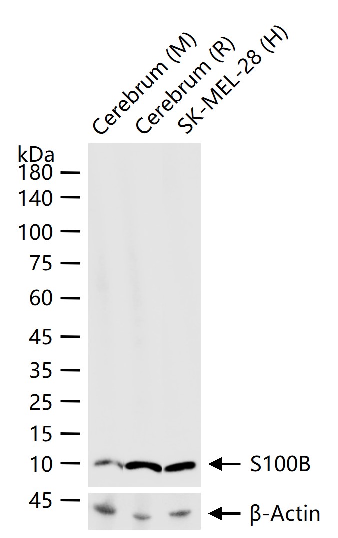 S100B蛋白重组兔单抗