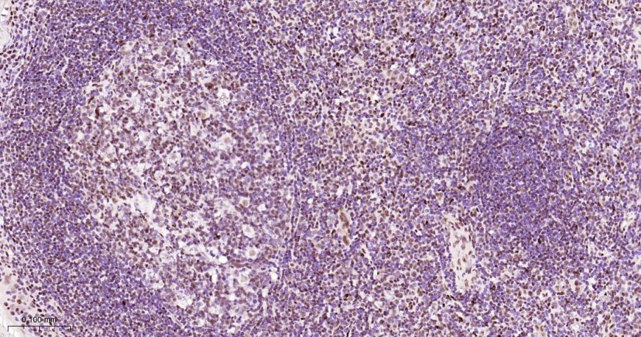 p53结合蛋白1重组兔单抗