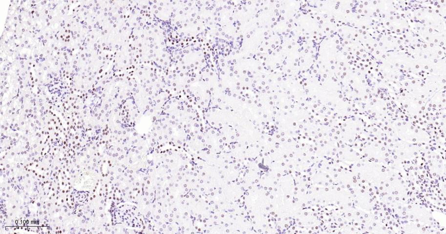 p53结合蛋白1重组兔单抗