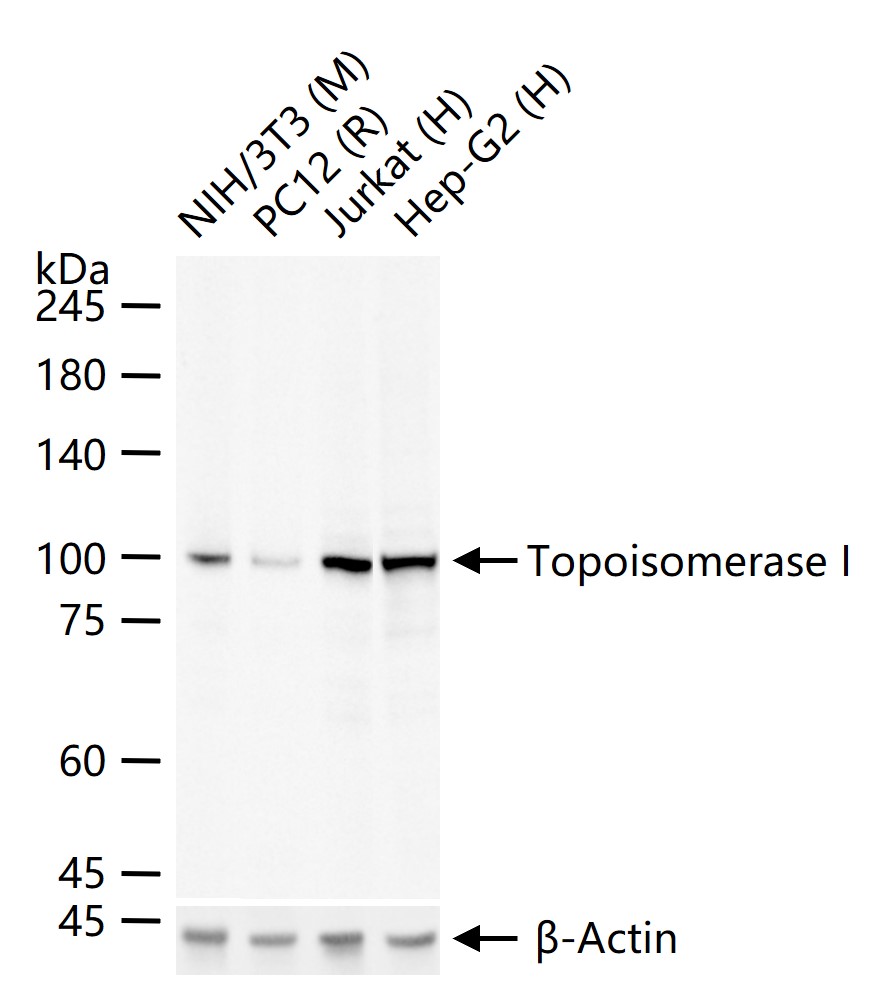 拓普西异构酶Ⅰ重组兔单抗