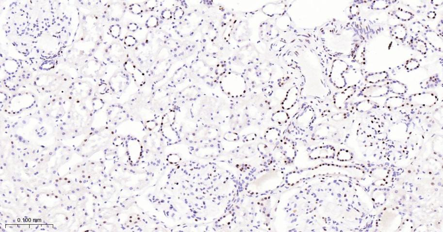 p53结合蛋白1重组兔单抗