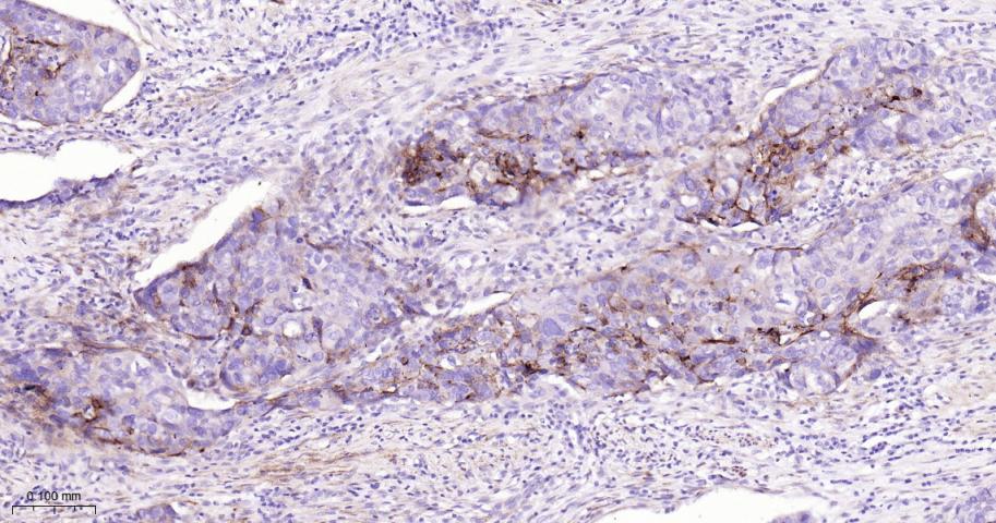滋养层细胞糖蛋白5T4重组兔单抗