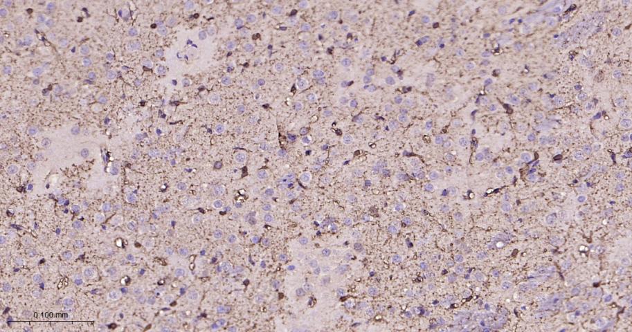 S100B蛋白重组兔单抗