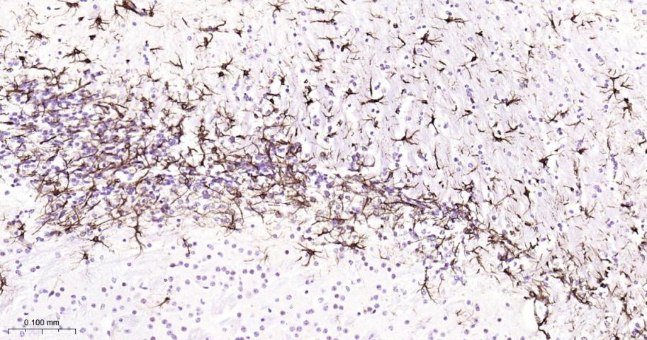 GFAP Rabbit pAb (一抗) - IHC-P,IHC-F,IF,Flow-Cyt | Bioss