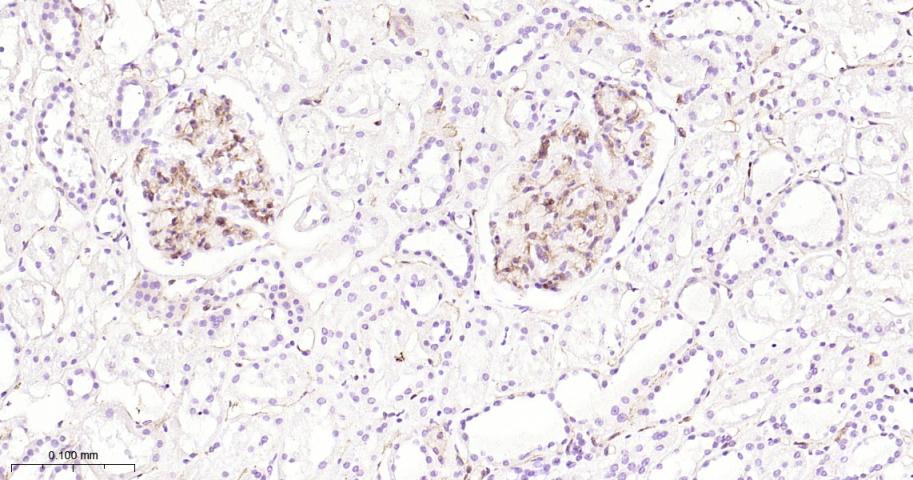 整合素α5（CD49e）重组兔单抗