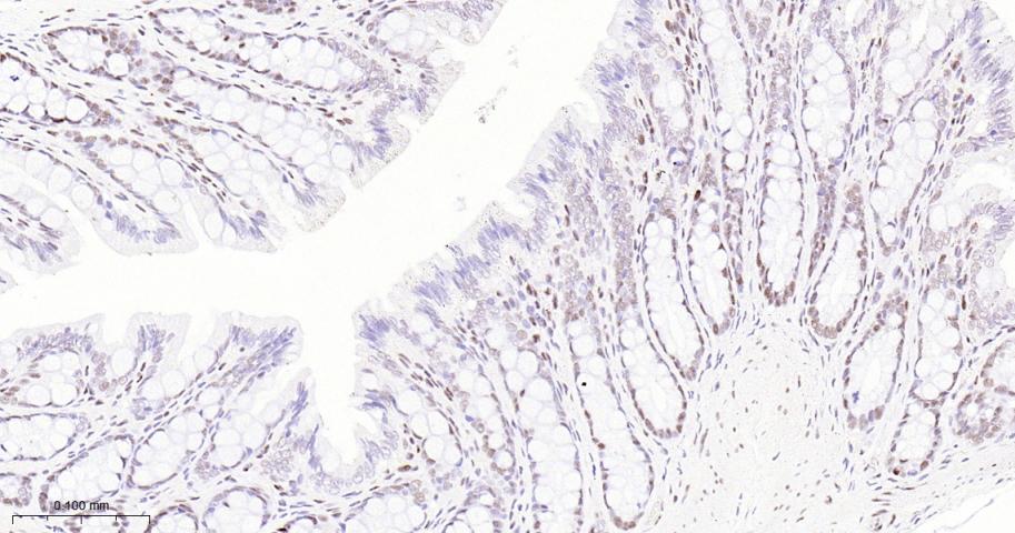 p53结合蛋白1重组兔单抗