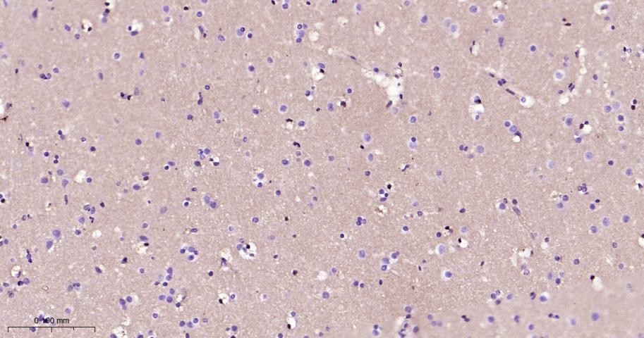 钙粘蛋白6重组兔单抗