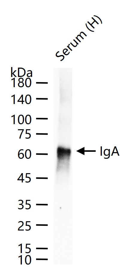 人免疫球蛋白A重组兔单抗