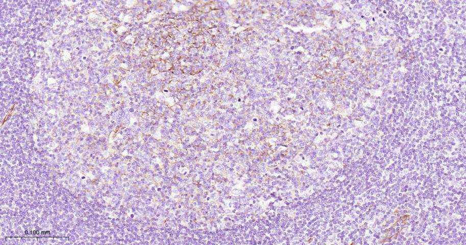 整合素α5（CD49e）重组兔单抗