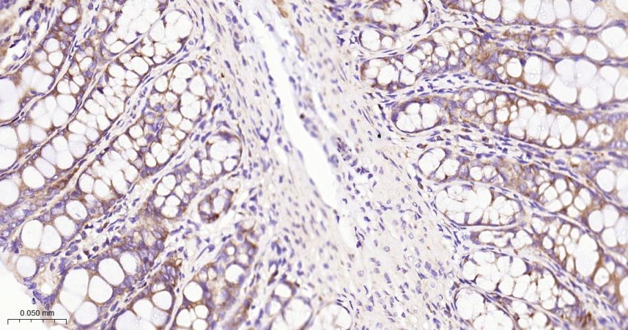 真核启动因子2α(eIFα2)兔单克隆抗体