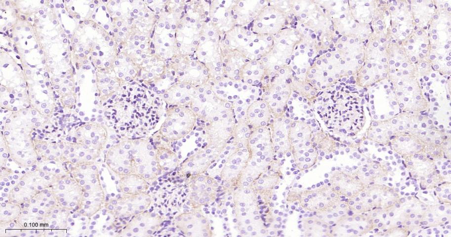 钙粘蛋白6重组兔单抗