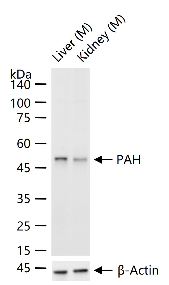 苯丙氨酸羟化酶4重组兔单抗