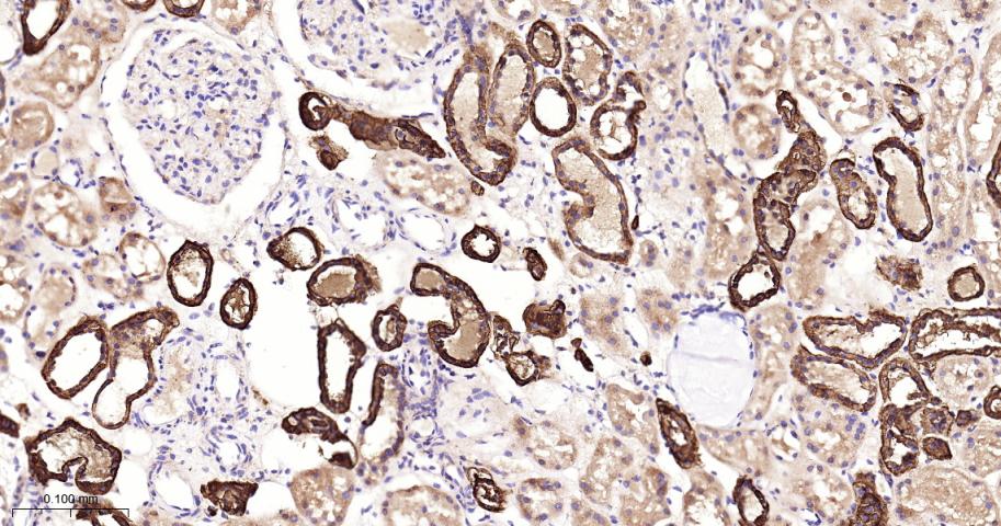 丝氨酸蛋白酶10重组兔单抗