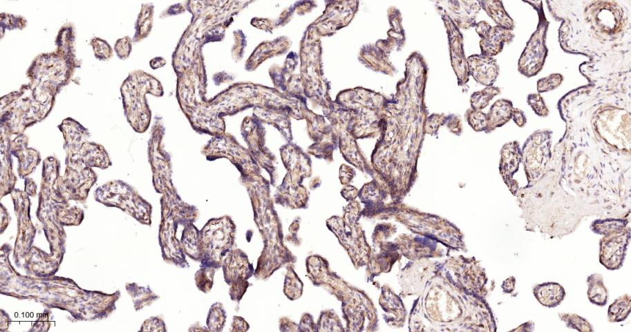 脱帽酶1A重组兔单抗