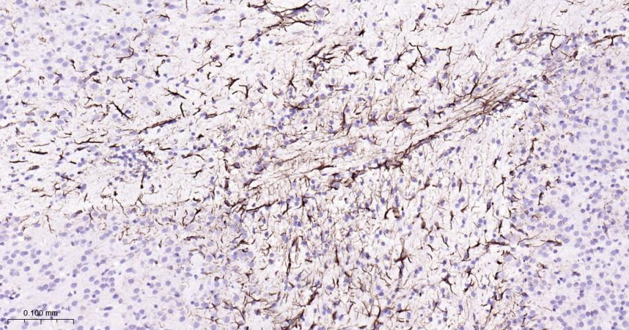 胶质纤维酸性蛋白抗体-bs-0199R