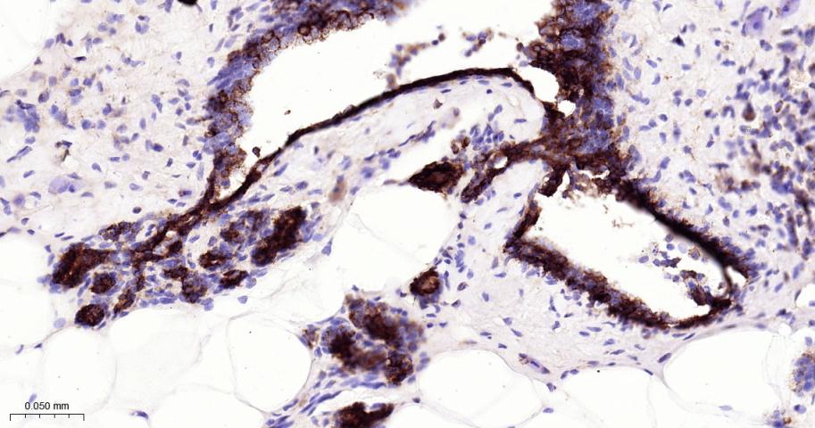 真核启动因子2α(eIFα2)兔单克隆抗体