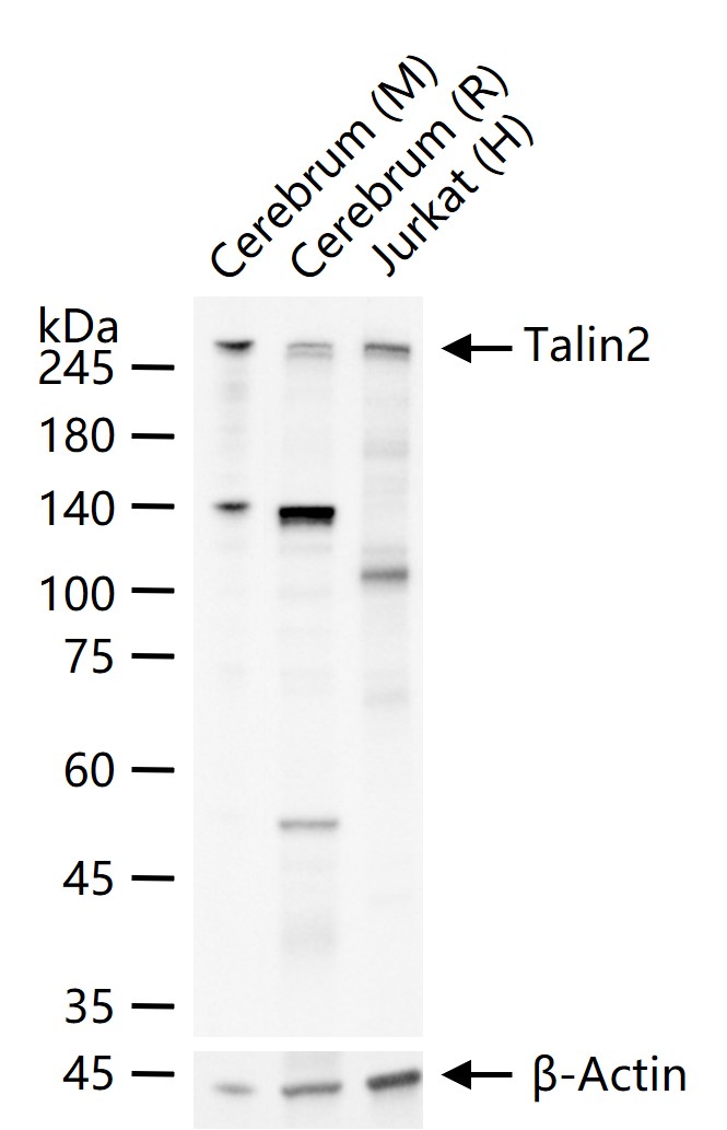 踝蛋白2重组兔单抗