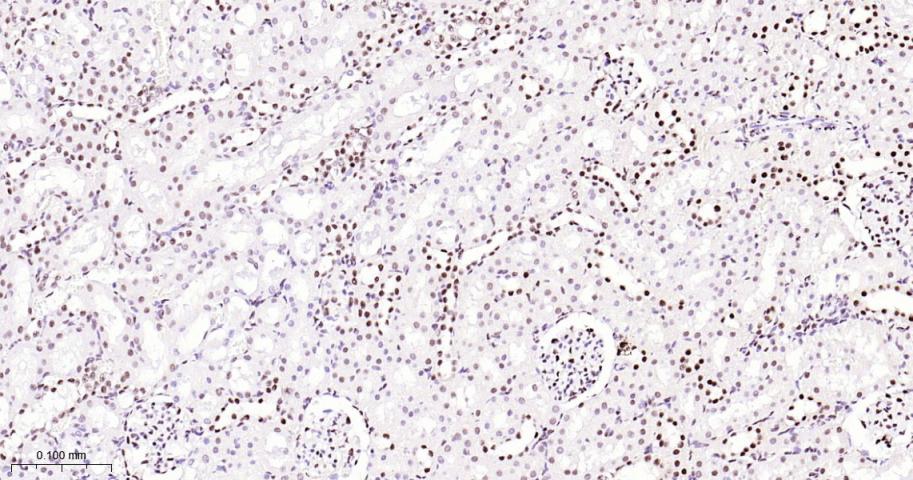 p53结合蛋白1重组兔单抗