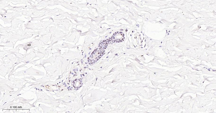 微小细胞血症相关转录因子重组兔单抗